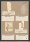 Navicula bullata Norman. (de-Toni-Nr.: Genus 1, Species 341) Zeichnungen Sammlung Grunow Nr. 784 (NHMW-BOT-W0367195)